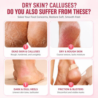 SoftStep Heel Spa Socks
